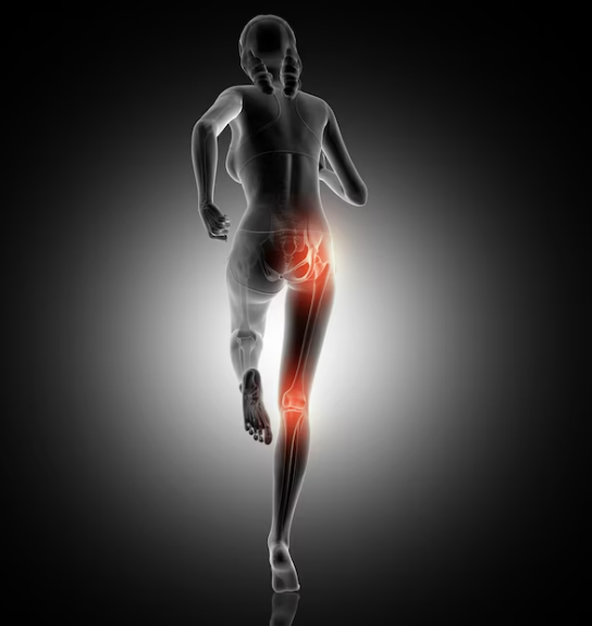 Benefícios do pilates imagem raio x