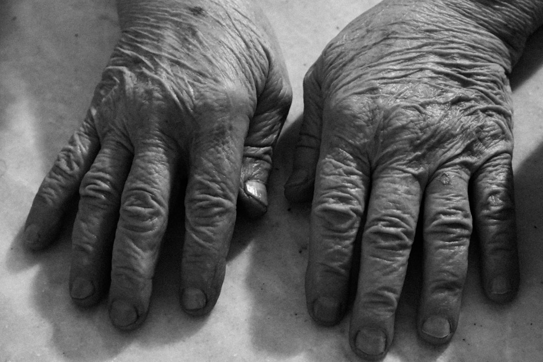 Mãos idosas com pele muito enrugada e ressecada em close.